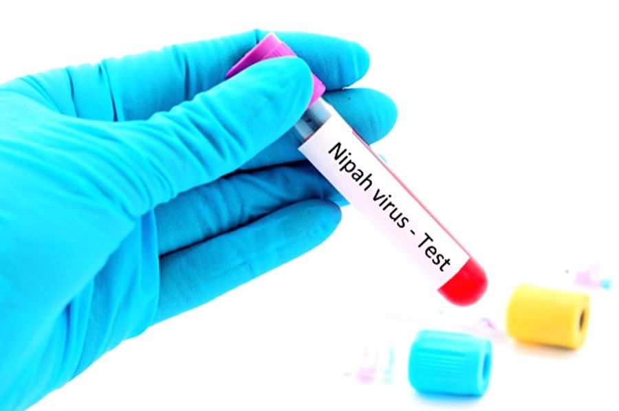 First human trial for deadly Nipah virus vaccine begins in UK - Vimarsana News