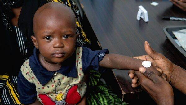 1st clinical trial of measles vaccine delivery via stickers shows promise - Vimarsana News