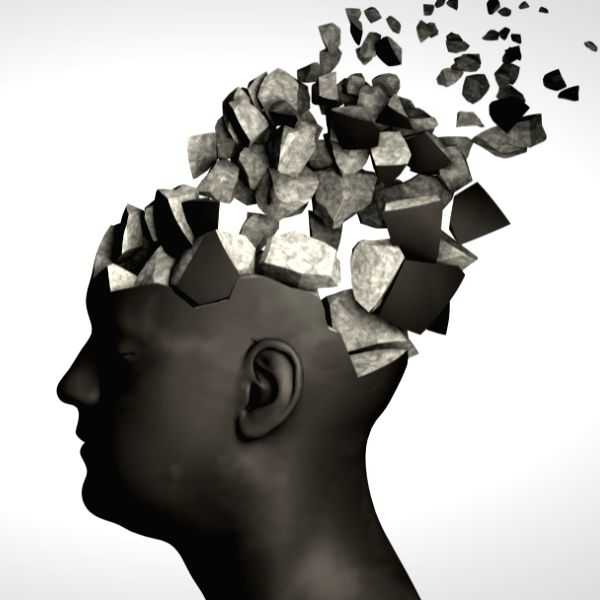 Scientists find 1st evidence of medically acquired Alzheimer's - Vimarsana News