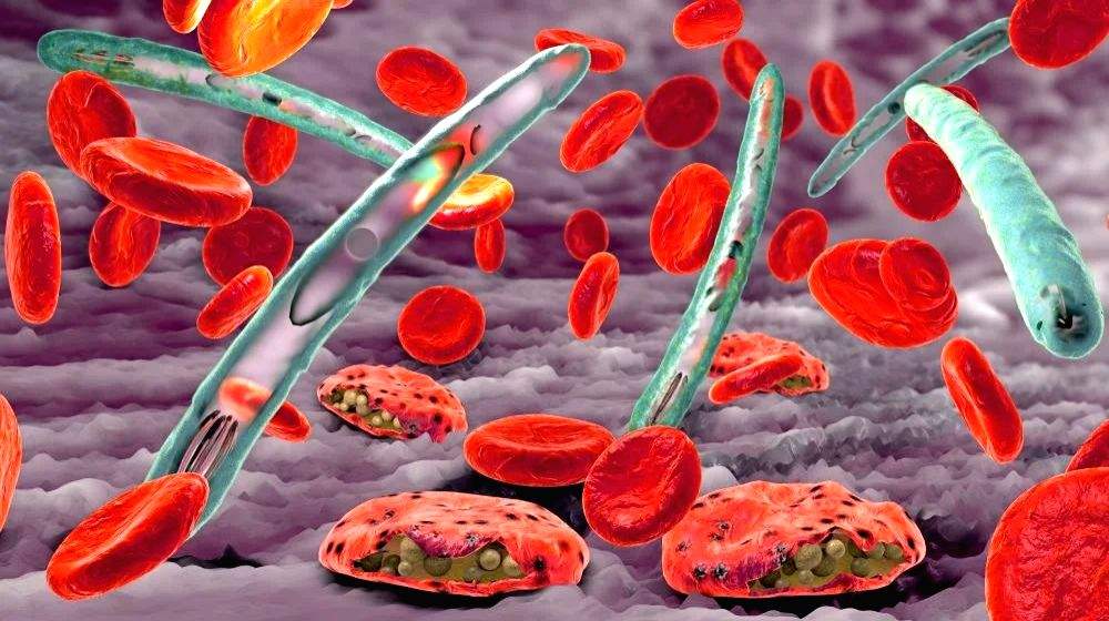 AI-based automated microscope successfully detects malaria in travellers - Vimarsana News