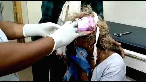 MP Shocker: Woman's head wound dressed with condom pack at community health centre - Vimarsana News