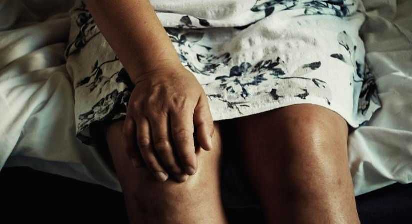Arthritis on the rise among women post Covid, say experts - Vimarsana News