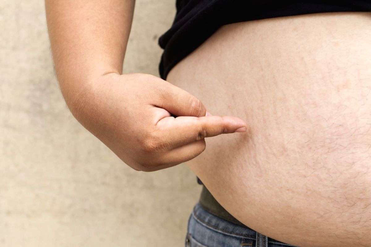 Obesity may up heart disease risk in women than pregnancy complications - Vimarsana News