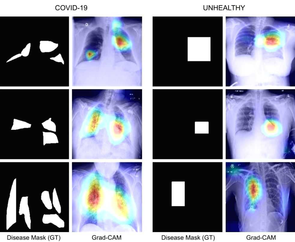 IIT Jodhpur team develops Covid diagnosis technique using chest X-Ray - Vimarsana News