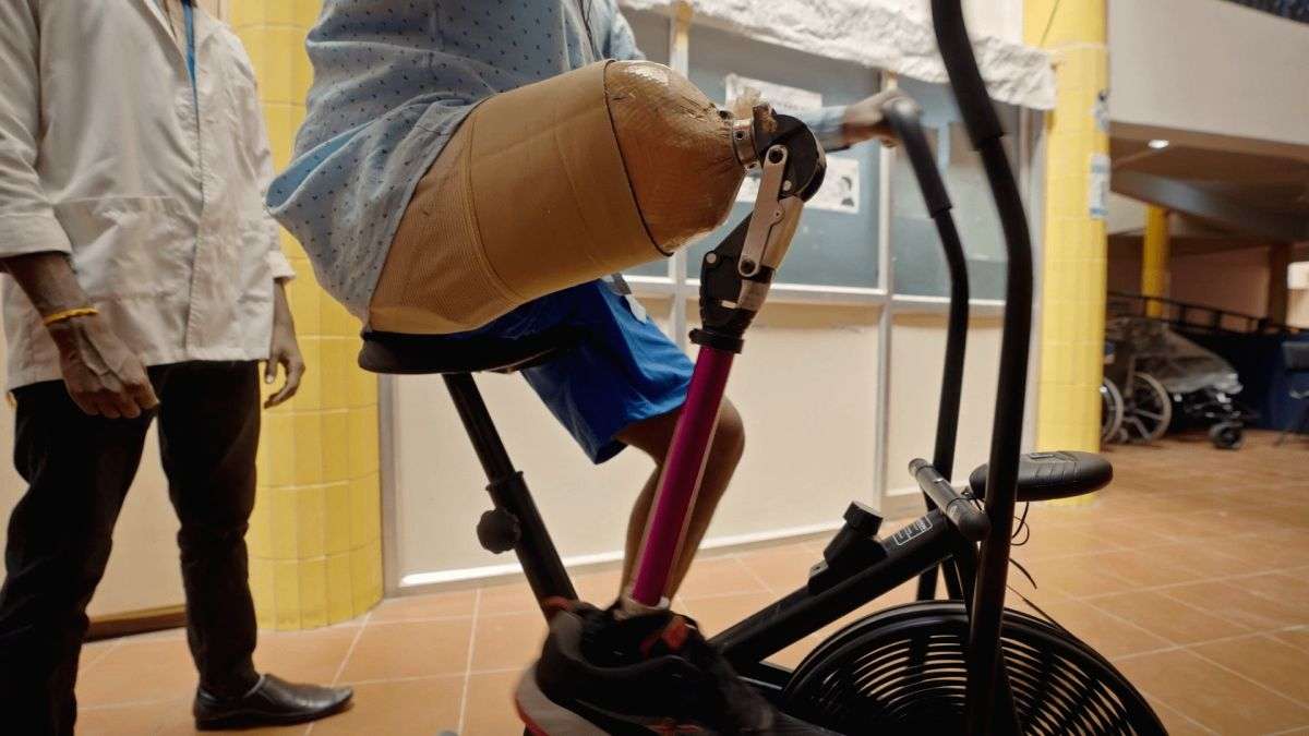 IIT Madras launches indigenously developed polycentric prosthetic knee - Vimarsana News