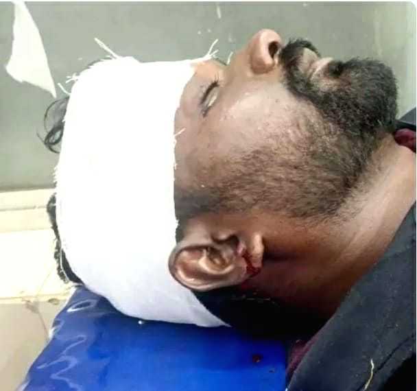 K'taka: BJP worker attacked for questioning Cong MLA on social media - Vimarsana News