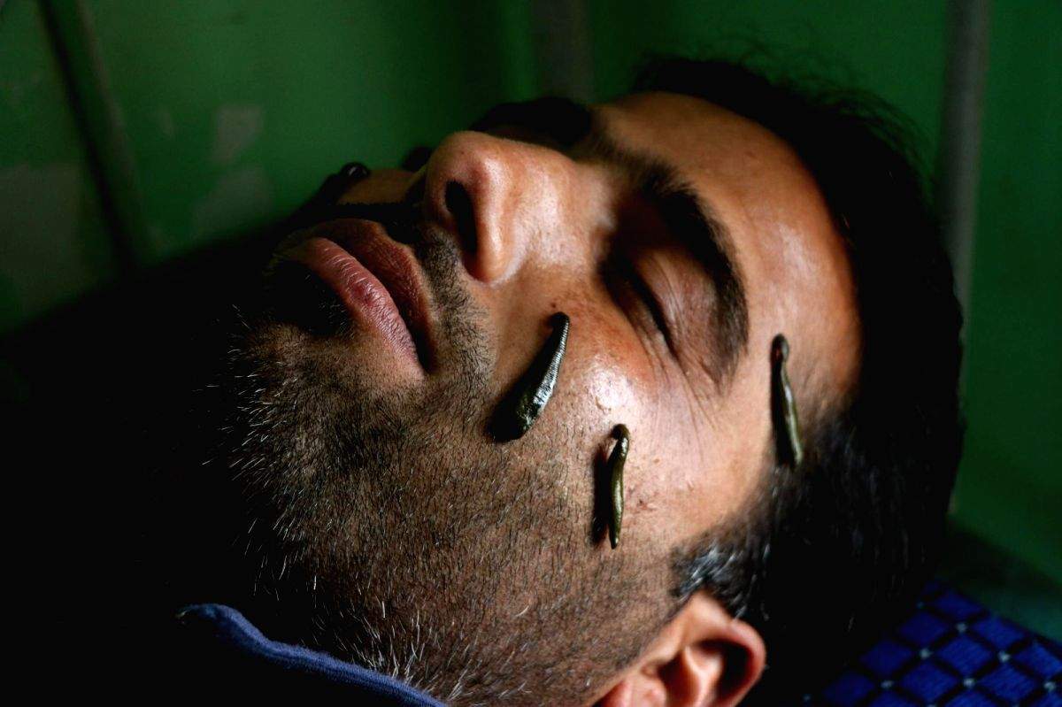 Now a leech bank! - Vimarsana News