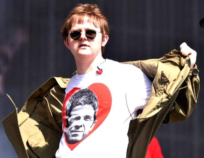 Lewis Capaldi reveals he has Tourette's Syndrome - Vimarsana News