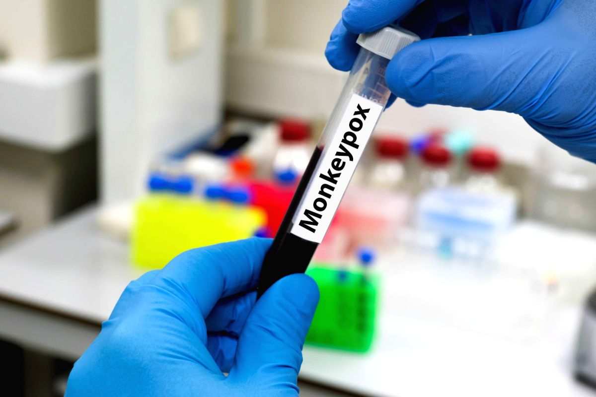 Smallpox vax protection against monkeypox may not be lasting: Lancet - Vimarsana News