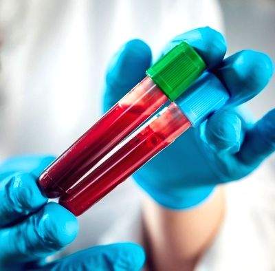 New blood test to detect 50 types of cancer shows promise - Vimarsana News