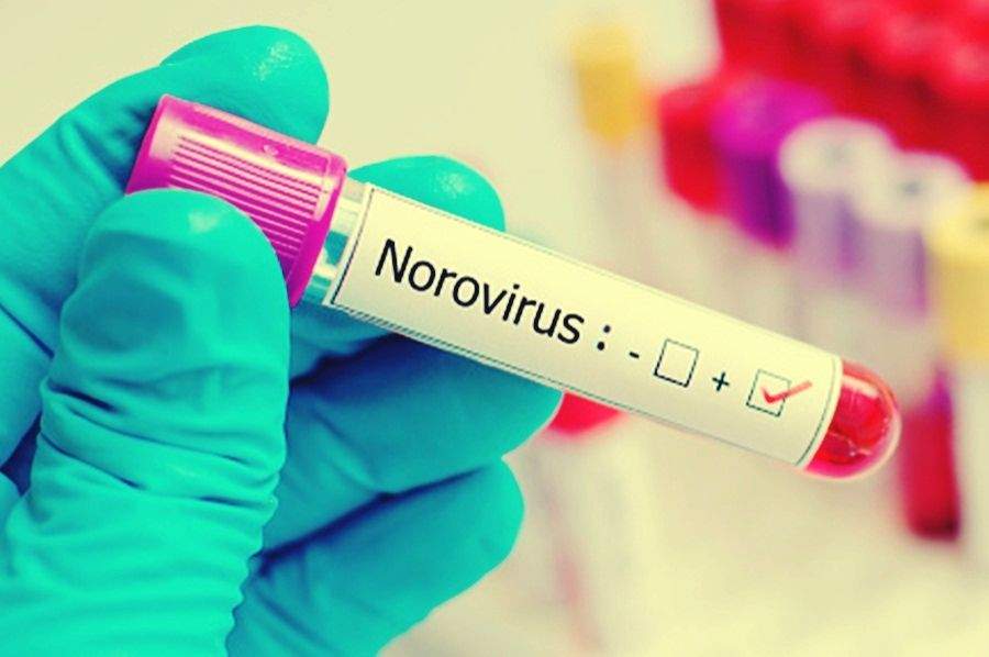 Scientists find norovirus, other gut viruses can spread through saliva - Vimarsana News