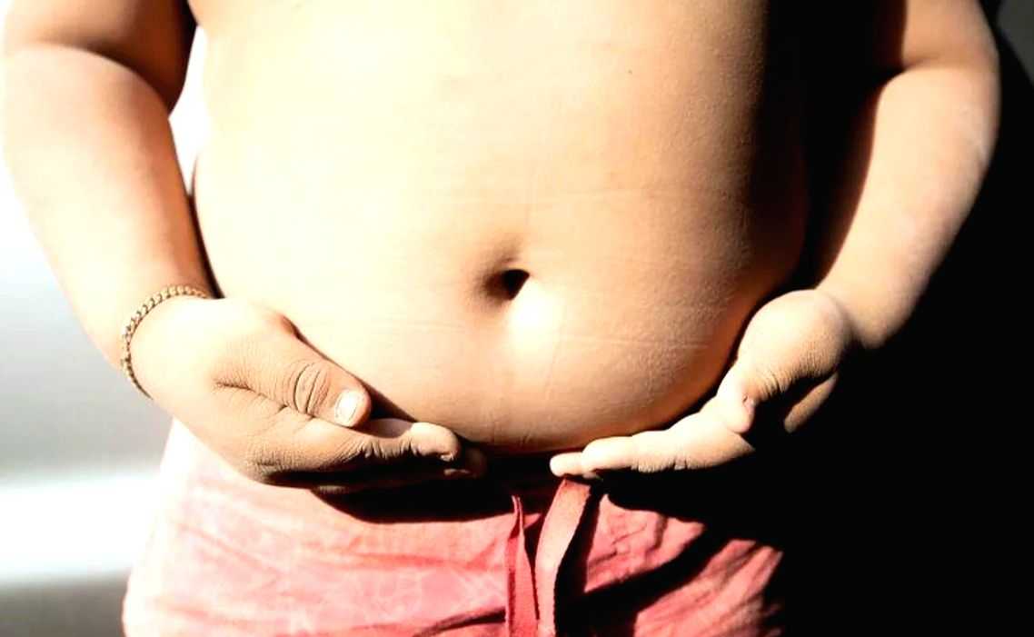79% Americans think surgery for weight loss should be last resort: Study - Vimarsana News
