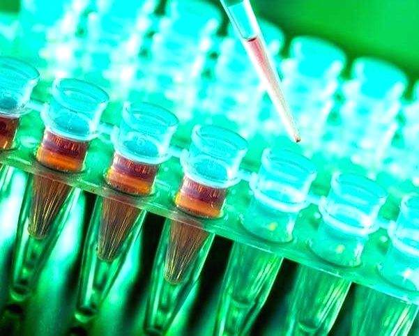 In a first in UP, Lucknow gurdwara to offer pathology tests - Vimarsana News