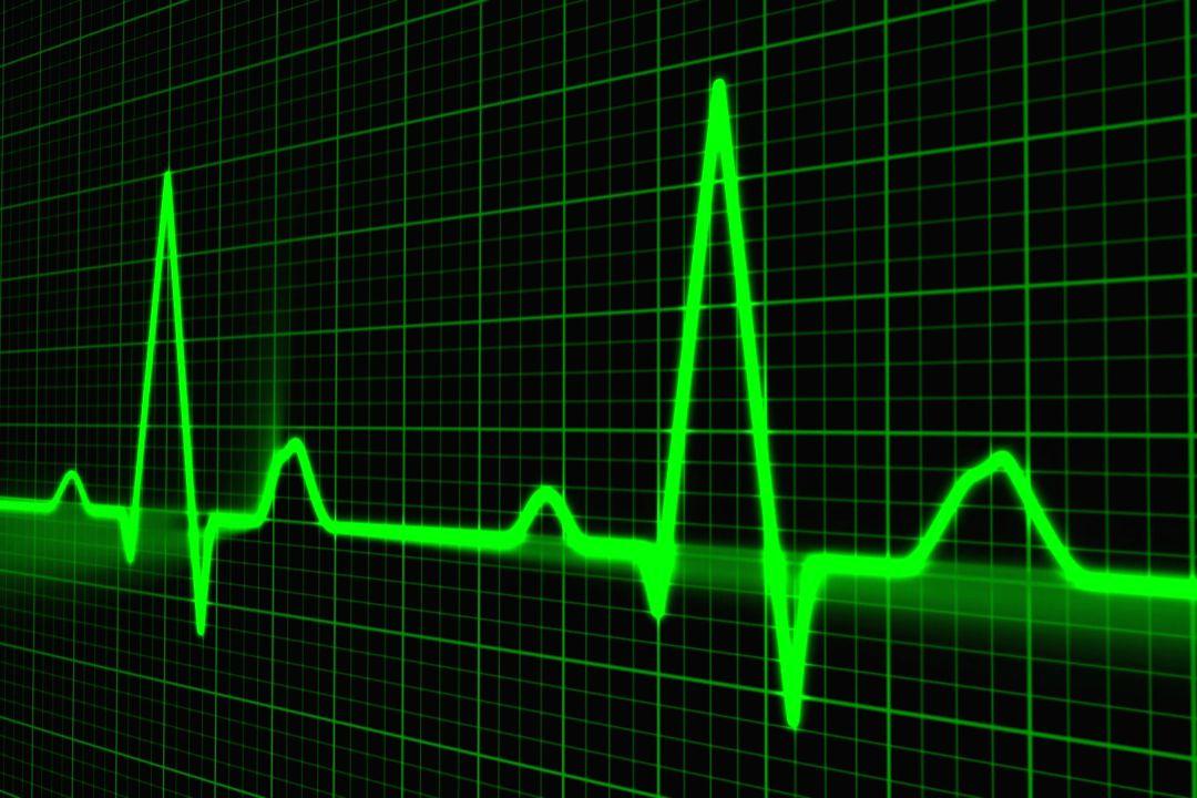 How precision cardiology with personalised care can help India tackle CVD burden - Vimarsana News