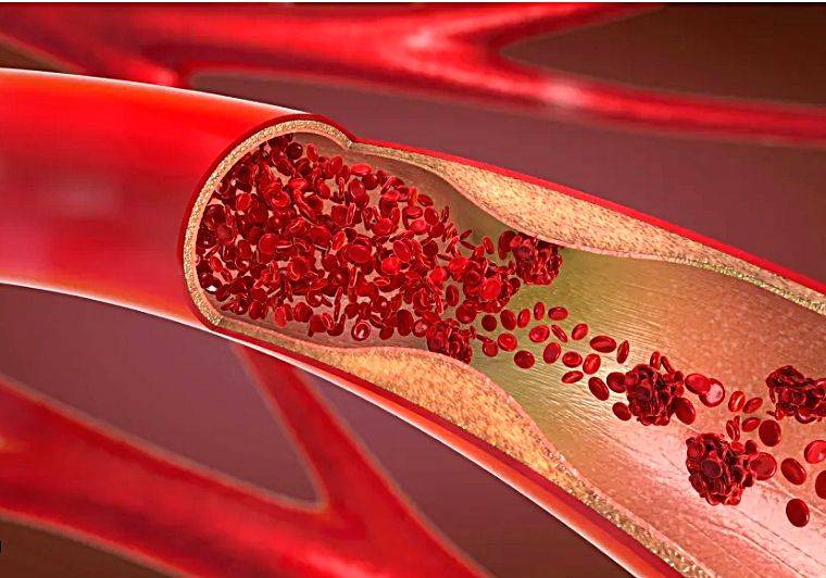 Scientists edge closer to engineering blood vessels - Vimarsana News