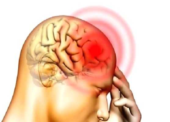 Study predicts increased resurgence in invasive meningitis cases - Vimarsana News