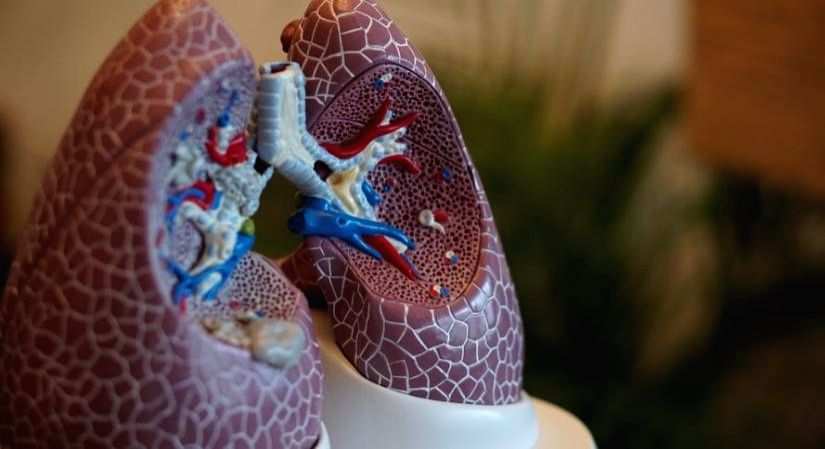 Damage caused by polluted air extends way beyond the lungs - Vimarsana News