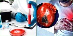 A simple blood test to predict risk of heart attack within six months - Vimarsana News