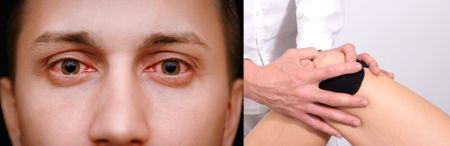 After pink eye, Delhi doctors report 50% rise in joints pain & arthritis - Vimarsana News