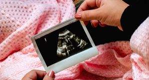 Important facts about surrogacy and its legalities - Vimarsana News