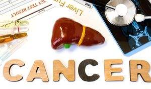 Liver cancer cure possible through target therapy: research - Vimarsana News