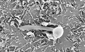 New insights into fungal infections can lead to better treatments - Vimarsana News