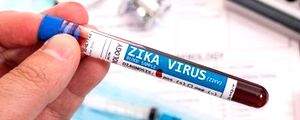 Prior Zika infection may spike risk of severe dengue: Study - Vimarsana News