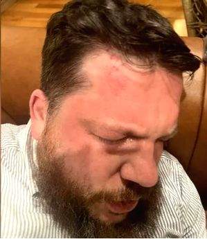 Putin critic Navalny's ally Leonid Volkov attacked in Lithuania - Vimarsana News