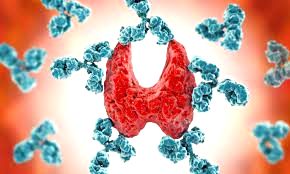 Rising incidence of autoimmune diseases among women cause for major concern - Vimarsana News
