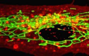 Study finds blood biomarkers linked to suicidal thoughts - Vimarsana News