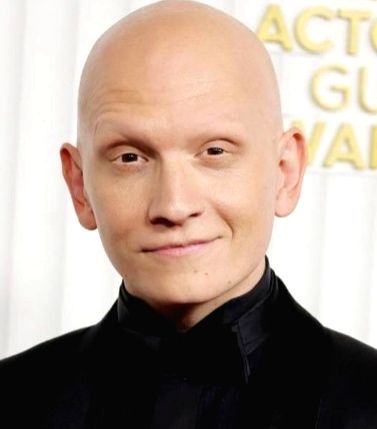 'Superman Legacy': Anthony Carrigan wanted to play Metamorpho before he even got the role - Vimarsana News