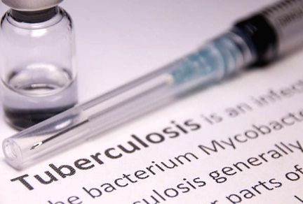New, shorter drug-resistant tuberculosis treatment shows promise - Vimarsana News