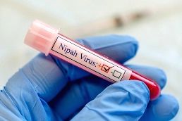 US scientists develop Nipah virus vax that can save lives in just 3 days - Vimarsana News