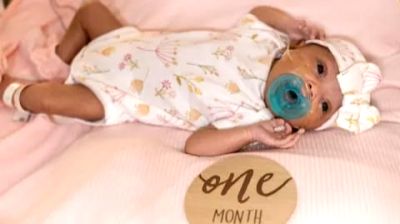US doctors perform first-ever brain surgery on a unborn baby - Vimarsana News