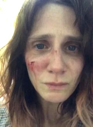 Victim of domestic abuse, French actress posts shocking pics on Instagram - Vimarsana News