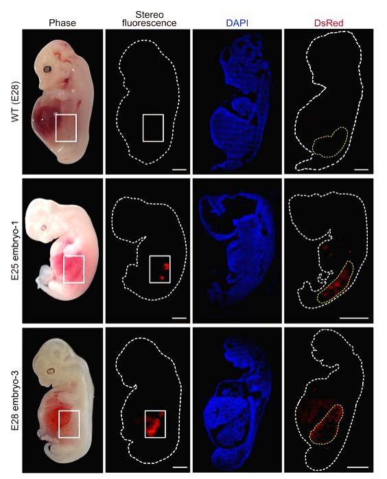 World's first human-like kidneys in grown pigs - Vimarsana News